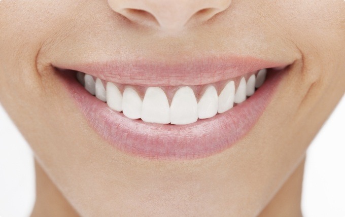 CLose up of person with straight white teeth smiling
