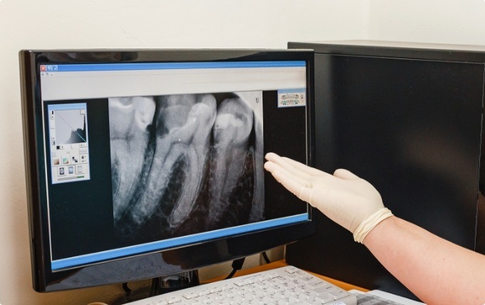 Dentist showing a patient their digital dental x rays on computer screen