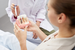 Dentist pointing to a dental implant